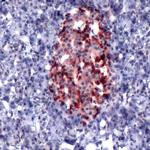 SOCS2 Antibody in Immunohistochemistry (IHC)