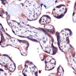 SOCS3 Antibody in Immunohistochemistry (IHC)