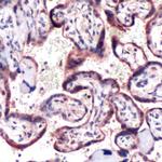 SOCS6 Antibody in Immunohistochemistry (IHC)