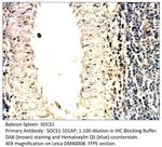 SOCS1 Antibody in Immunohistochemistry (IHC)