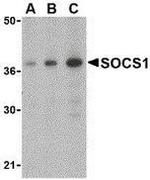 SOCS1 Antibody in Western Blot (WB)