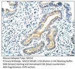 SOCS3 Polyclonal Antibody