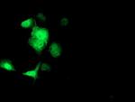 SOCS3 Antibody in Immunocytochemistry (ICC/IF)