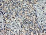 SOCS3 Antibody in Immunohistochemistry (Paraffin) (IHC (P))