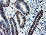 SOCS3 Antibody in Immunohistochemistry (Paraffin) (IHC (P))