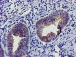 SOCS3 Antibody in Immunohistochemistry (Paraffin) (IHC (P))