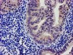 SOCS3 Antibody in Immunohistochemistry (Paraffin) (IHC (P))