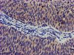 SOCS3 Antibody in Immunohistochemistry (Paraffin) (IHC (P))