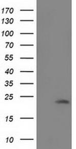 SOD2 Antibody in Western Blot (WB)