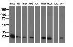 SOD2 Antibody in Western Blot (WB)