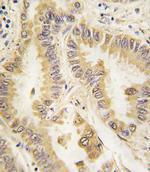 SOD2 Antibody in Immunohistochemistry (IHC)