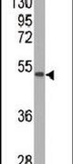 SOD2 Antibody in Western Blot (WB)