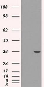 SORD Antibody in Western Blot (WB)