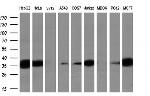 SORD Antibody in Western Blot (WB)