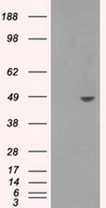 SORD Antibody in Western Blot (WB)