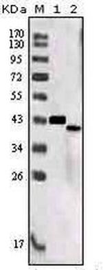 SORL1 Monoclonal Antibody (7D7B11)