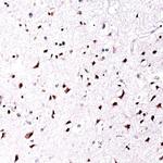 SOX4 Antibody in Immunohistochemistry (IHC)