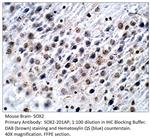 SOX2 Antibody in Immunohistochemistry (IHC)