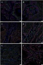 SOX2 Antibody in Immunohistochemistry (Paraffin) (IHC (P))