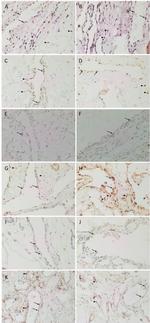 SOX2 Antibody in Immunohistochemistry (IHC)