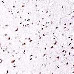 SOX4 Antibody in Immunohistochemistry (IHC)