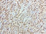 SOX5 Antibody in Immunohistochemistry (Paraffin) (IHC (P))