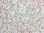 SOX5 Antibody in Immunohistochemistry (Paraffin) (IHC (P))