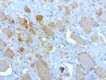 SOX5 Antibody in Immunohistochemistry (Paraffin) (IHC (P))