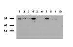 SOX5 Antibody in Western Blot (WB)