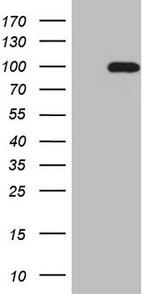 SOX6 Antibody in Western Blot (WB)