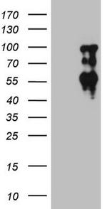 SOX6 Antibody in Western Blot (WB)