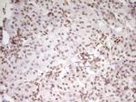SP110 Antibody in Immunohistochemistry (Paraffin) (IHC (P))
