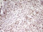 SP110 Antibody in Immunohistochemistry (Paraffin) (IHC (P))
