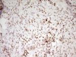 SP110 Antibody in Immunohistochemistry (Paraffin) (IHC (P))