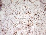 SP110 Antibody in Immunohistochemistry (Paraffin) (IHC (P))
