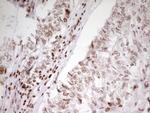 SP110 Antibody in Immunohistochemistry (Paraffin) (IHC (P))