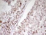 SP110 Antibody in Immunohistochemistry (Paraffin) (IHC (P))