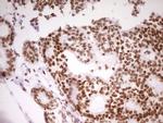 SP110 Antibody in Immunohistochemistry (Paraffin) (IHC (P))