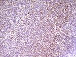 SP110 Antibody in Immunohistochemistry (Paraffin) (IHC (P))