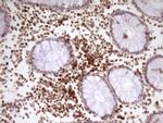 SP110 Antibody in Immunohistochemistry (Paraffin) (IHC (P))
