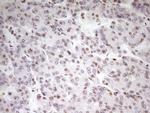 SP110 Antibody in Immunohistochemistry (Paraffin) (IHC (P))