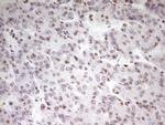 SP110 Antibody in Immunohistochemistry (Paraffin) (IHC (P))