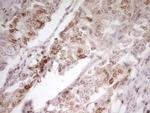 SP110 Antibody in Immunohistochemistry (Paraffin) (IHC (P))