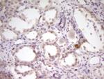 SP110 Antibody in Immunohistochemistry (Paraffin) (IHC (P))
