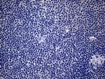 SP110 Antibody in Immunohistochemistry (Paraffin) (IHC (P))