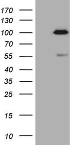 SP110 Antibody in Western Blot (WB)