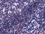 SP1 Antibody in Immunohistochemistry (IHC)