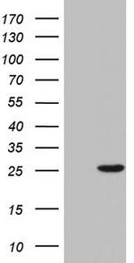 SPA17 Antibody in Western Blot (WB)