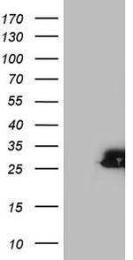 SPA17 Antibody in Western Blot (WB)