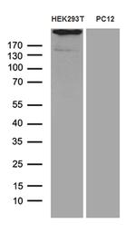 SPAG5 Antibody in Western Blot (WB)